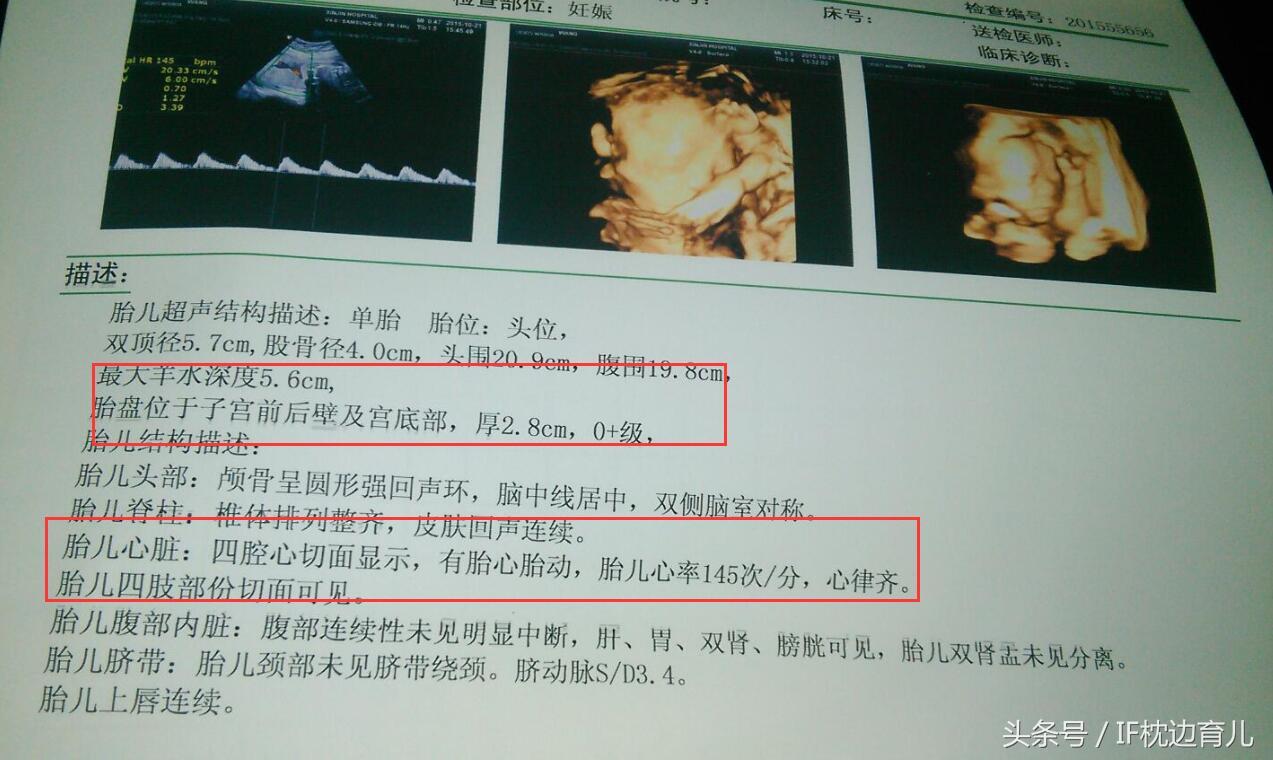 几个月可以做四维彩超，了解孕期彩超的最佳时间